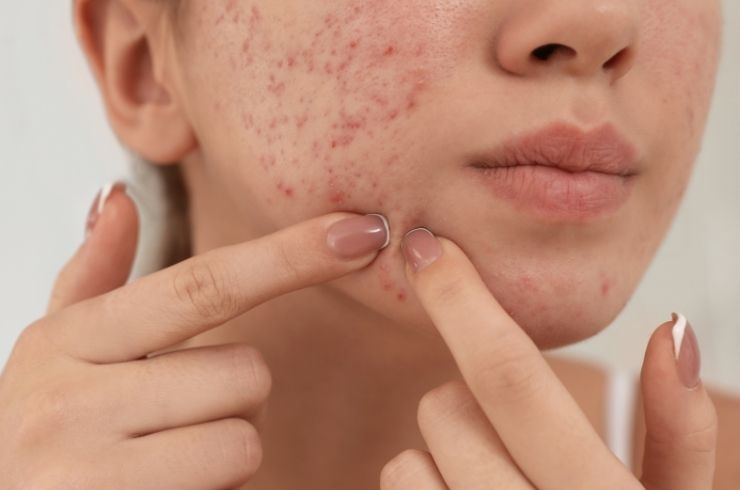 OJAS Skin, Hair & Laser Clinic