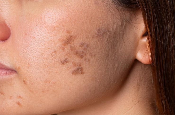 OJAS Skin, Hair & Laser Clinic