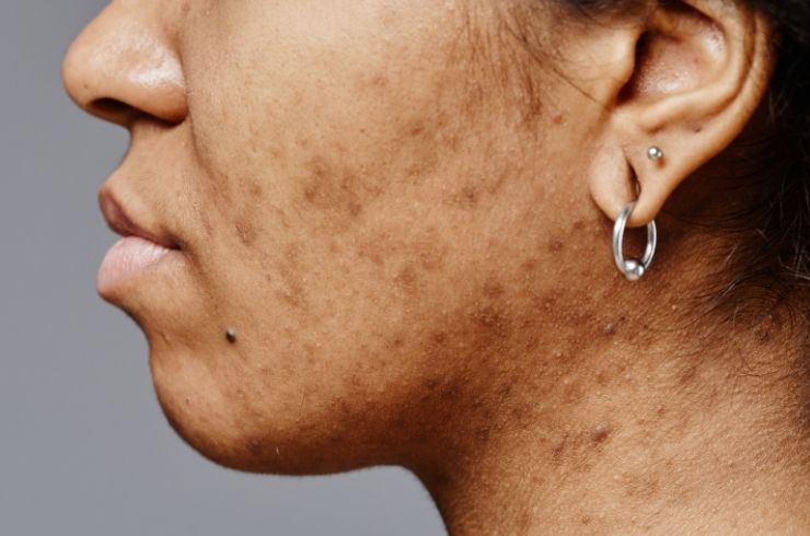OJAS Skin, Hair & Laser Clinic