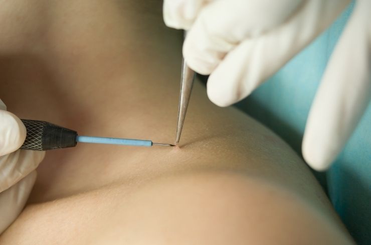 OJAS Skin, Hair & Laser Clinic